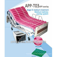 dynamic medical alternating mattress overlay system for decubitus APP-T03